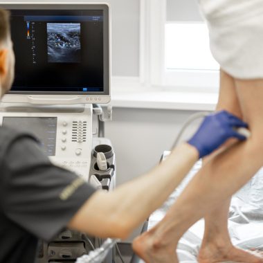 Ce este ecografia de tendon?